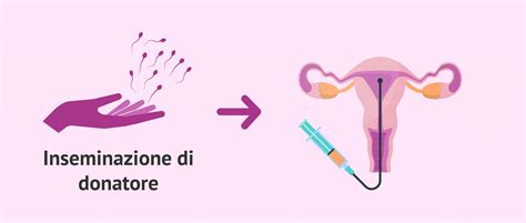 schema dell'inseminazione artificiale