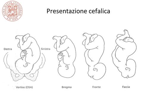 Illustrazione delle diverse presentazioni fetali: cefalica, podalica, di spalla