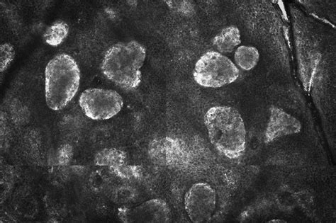 Microscopia confocale di un embrione murino allo stadio di morula con cellule evidenziate