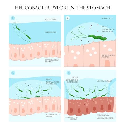 Illustrazione scientifica di Helicobacter pylori
