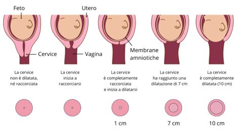 Illustrazione anatomica della cervice uterina