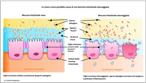 Diagramma dell'atresia intestinale