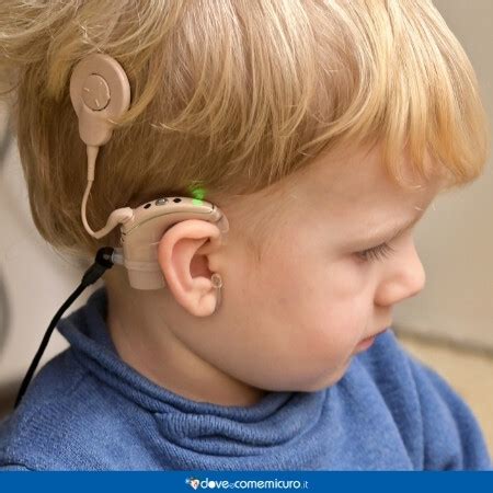 Bambino con impianto cocleare che gioca