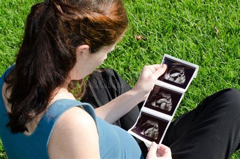 Donna incinta che guarda un ecografia