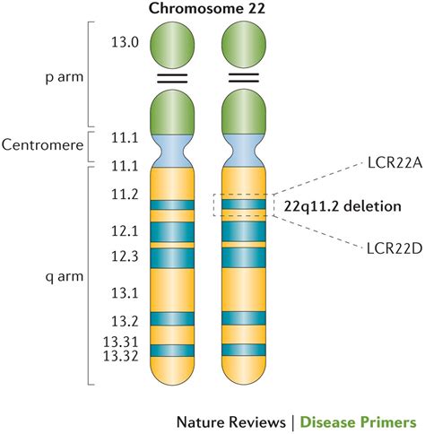 Schema che illustra la posizione della delezione sul cromosoma 22 associata alla sindrome 22q11.2.