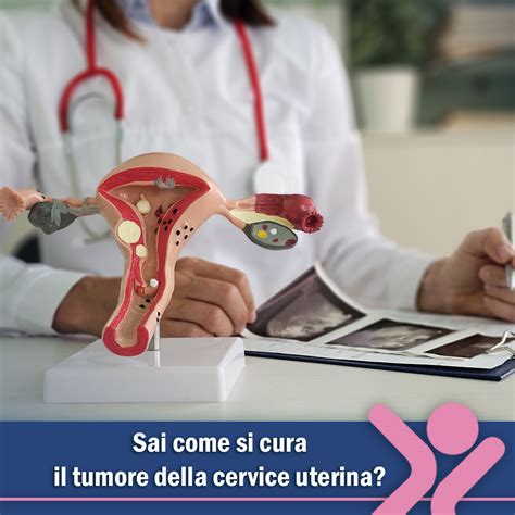 Struttura della cervice uterina