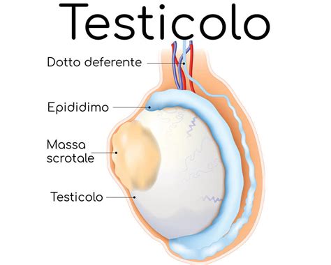 Schema delle tipologie di tumore testicolare